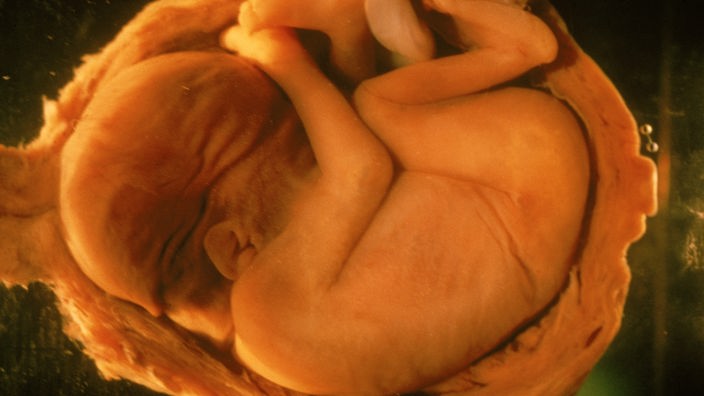 Anatomie Des Menschen Schwangerschaft Schwangerschaft Natur Planet Wissen